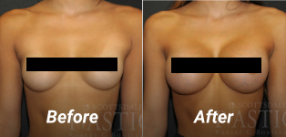 Before & After Patient Procedure