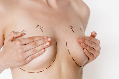 Breast Lift Procedure Arizona